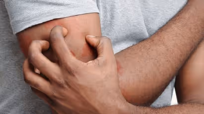 തണുപ്പ് തീരെ സഹിക്കായ്ക, ശരീരത്തില്‍ ചൊറിച്ചിലും വരള്‍ച്ചയും ; കാരണമിതാകാം...