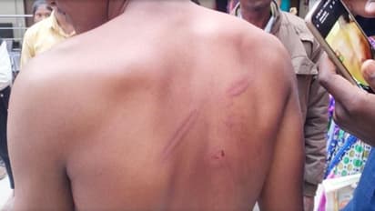 एक दिन स्कूल न आने पर बच्चे की बेरहमी से पिटाई, आरोपी शिक्षक के खिलाफ कार्रवाई की मांग को लेकर हंगामा