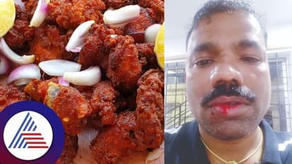 Bengaluru: 1 ಪೀಸ್ ಕಬಾಬ್ ಕಮ್ಮಿಕೊಟ್ಟ ಹೋಟೆಲ್ ಮಾಲೀಕನಿಗೆ ಥಳಿತ