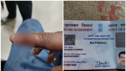 തൃശൂരില് യുവാവ് ആംബുലൻസ് ഡ്രൈവറുടെ കൈ വിരൽ കടിച്ചുമുറിച്ചു