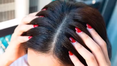 താരൻ അകറ്റാൻ ഈ രണ്ട് ചേരുവകൾ ഉപയോഗിക്കാറുണ്ടോ? എങ്കിൽ ശ്രദ്ധിക്കൂ