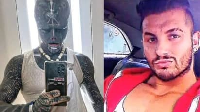 ബോഡി മോഡിഫിക്കേഷൻ നടത്തി; ഭയന്ന് ഭക്ഷണം നൽകാൻ തയ്യാറാകാതെ റെസ്റ്റോറന്റുകൾ