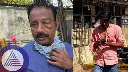 Ballari: ವಿದ್ಯತ್ ಬಿಲ್ ಕೇಳಿದ ಜೆಸ್ಕಾಂ ಸಿಬ್ಬಂದಿ ಮೇಲೆ ಹಲ್ಲೆ: ₹ 9 ಸಾವಿರ ವಿದ್ಯುತ್ ಬಿಲ್ ಬಾಕಿ