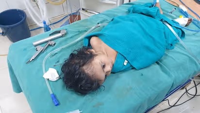 கோவையில் குழந்தையின் மூச்சுக்குழாயில் துகள்; வெற்றிகரமாக அகற்றி அரசு மருத்துவர்கள் அசத்தல்