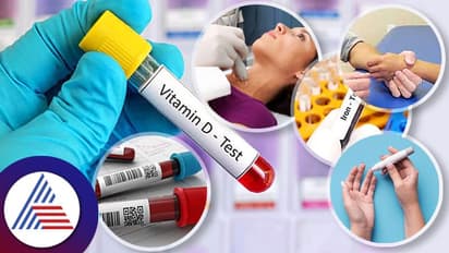 Health Tips: ವರ್ಷಕ್ಕೊಮ್ಮೆ ಈ ಪರೀಕ್ಷೆ ಮಾಡಿಸ್ಕೊಳ್ಳಿ, ಆರೋಗ್ಯಕರ ಜೀವನ ನಡೆಸಿ