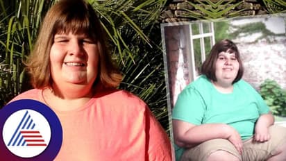 Childhood Obesity: ಐದು ವರ್ಷಕ್ಕೇ ಈಕೆ ತೂಕ 45KG: ಕಾರಣವೇನು ಗೊತ್ತಾ? 