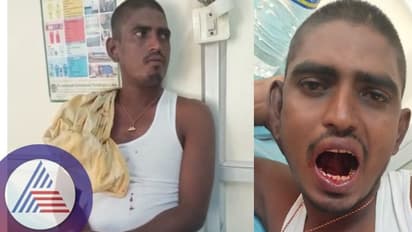 Ballari : ದೇವರು ಕೇಳಿದನೆಂದು ನಾಲಿಗೆಯನ್ನೇ ಕೊಯ್ದುಕೊಟ್ಟ ಭೂಪ