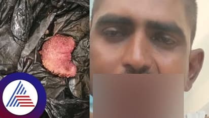 ಕನಸಲ್ಲಿ ದೇವರು ಹೇಳಿದ್ದಕ್ಕೆ ನಾಲಗೆ ಕತ್ತರಿಸಿಕೊಂಡ ಬಳ್ಳಾರಿ ಯುವಕ!