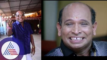 ಅರವಿಂದ್ ಬೋಳಾರ್ಗೆ ಅಪಘಾತ: ಬೈಕ್ ಬೀಳದಿದ್ದರೆ ಪ್ರಾಣಕ್ಕೆ ಅಪಾಯವಿತ್ತು..!