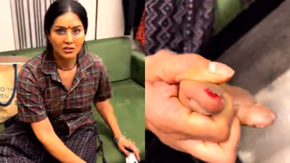 Video: Sunny Leone gets hurt, shares video of her bleeding toe on Instagram-WATCH