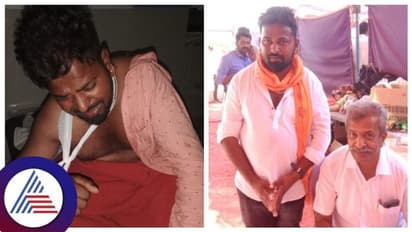 Chikkamagaluru: ಬಿಜೆಪಿಗೆ ಸೇರ್ಪಡೆಯಾಗಿದ್ದಕ್ಕೆ ಯುವಕನ ಕೈ ಮುರಿದ ಕಾಂಗ್ರೆಸ್ ಕಾರ್ಯಕರ್ತರು!
