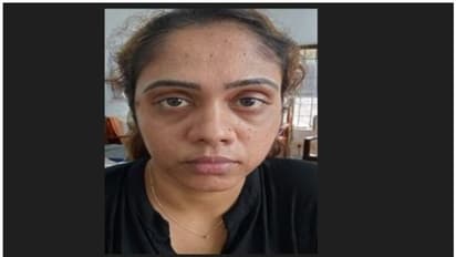 ഹോംസ്റ്റേ ഉടമയെ ഹണിട്രാപ്പിൽപ്പെടുത്തി 10 ലക്ഷം ആവശ്യപ്പെട്ട് മർദ്ദിച്ചു, യുവതി അറസ്റ്റിൽ