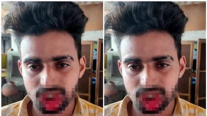 ರೇಪ್ ಮಾಡಲು ಯತ್ನಿಸಿದ ಪಾಪಿಯ ತುಟಿಯನ್ನೇ ಕಚ್ಚಿ ಕತ್ತರಿಸಿ ಬಚಾವ್ ಆದ ಯುವತಿ!