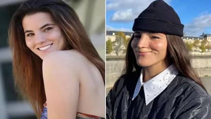 മോഡലിനെ കടിച്ചുകീറി പിറ്റ്‍ബുൾ, മേൽച്ചുണ്ട് പൂർണമായും നഷ്ടമായി, കടന്നുപോയത് ആറ് സർജറികളിലൂടെ