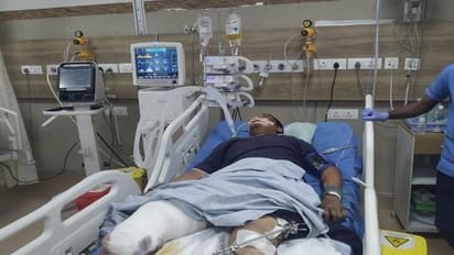 ಕಲಬುರಗಿ: ಪಿಎಸ್‌ಐ ಫೈರಿಂಗ್‌ ಪ್ರಕರಣ, ಆರೋಪಿ ಕಾಲು ಕತ್ತರಿಸಿದ ವೈದ್ಯರು