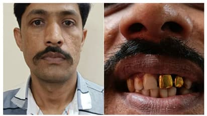 സ്വർണപ്പല്ല് ചതിച്ചു, 15 വർഷമായി പൊലീസിനെ വെട്ടിച്ച് ഒളിവിൽ കഴിഞ്ഞയാൾ പിടിയിൽ