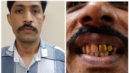 സ്വർണപ്പല്ല് 'കെണി'യായി; 15 വർഷത്തിനു ശേഷം പിടികിട്ടാപ്പുള്ളി പിടിയിൽ