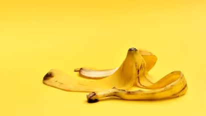 മുഖക്കുരു പരിഹരിക്കാൻ പഴത്തൊലി; അറിയാം ഇക്കാര്യങ്ങള്...