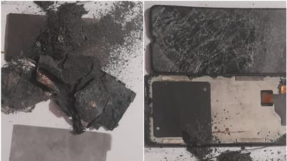 ഉപയോഗിച്ചുകൊണ്ടിരിക്കെ മൊബൈൽ പൊട്ടിത്തെറിച്ചു, അപകടം ആലപ്പുഴയിൽ, ആശുപത്രിയിൽ ചികിത്സ; പൊലീസിൽ പരാതിയും നൽകി