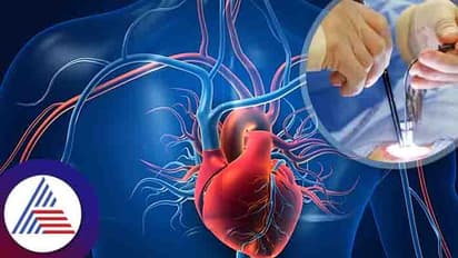 Laser Technology : ರಕ್ತನಾಳ ಬ್ಲಾಕೇಜ್ ತಡೆಯುತ್ತೆ ಲೇಸರ್ ಚಿಕಿತ್ಸೆ