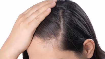 ഉള്ള് കുറഞ്ഞ തലമുടിയാണോ? പരീക്ഷിക്കാം ഈ കിടിലന്‍ ഹെയര്‍ പാക്കുകള്‍... 