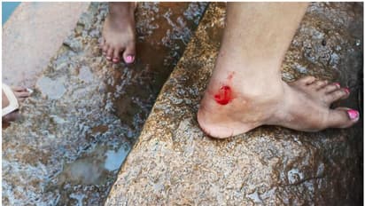 ആറ്റില് കുളിക്കുന്നതിനിടെ അപ്രതീക്ഷിത ആക്രമണം, നീര് നായയുടെ കടിയേറ്റ് നിരവധി പേർക്ക് പരിക്ക്, ഭയപ്പാടിൽ ജനം