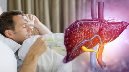 இந்த உணவுகள் கல்லீரலுக்கு எமன்! அவை மதுவை விட மோசமான விளைவை ஏற்படுத்துமாம்.. ஜாக்கிரதை..!