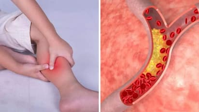 കൊളസ്ട്രോള്‍ കുറയ്ക്കാന്‍ വെറുംവയറ്റില്‍ കുടിക്കാം ഈ മൂന്ന് പാനീയങ്ങള്‍...