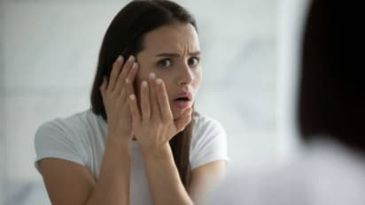 ഇവ ഉപയോഗിച്ചാല്‍ മതി, മുഖത്തെ കറുത്ത പാടുകള്‍ മാറ്റാം...