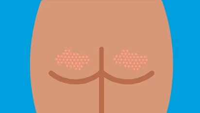 புட்டப் பகுதிகளில் பருக்கள் பிரச்னை- அலட்சியம் காட்ட வேண்டாம்..!!