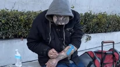 അടിച്ചുകഴിഞ്ഞാല്‍ തൊലി ചീഞ്ഞളിഞ്ഞ് പോകുന്ന കൊടിയ ലഹരി; അതിവേഗം വില്‍പനയെന്ന് യുഎസില്‍ നിന്ന് റിപ്പോര്‍ട്ട്