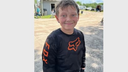 உஷார்.. சதை உண்ணும் பாக்டீரியா தாக்கியதால் சிறுவனுக்கு நேர்ந்த கதி..! இந்த அறிகுறிதான் காரணம்..