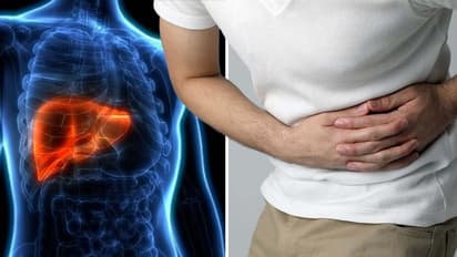 ഫാറ്റി ലിവർ രോഗം ഉണ്ടാകുന്നതിന് പിന്നിലെ കാരണങ്ങൾ