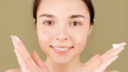 മുഖത്തെ കറുത്ത പാടുകളെ അകറ്റാന് നാല് ഫേസ് പാക്കുകള്...