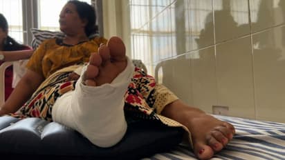 കാല് മാറി ശസ്ത്രക്രിയ: ഡോക്ടർക്ക് പിഴവ് പറ്റിയെന്ന് പ്രാഥമിക റിപ്പോർട്ട്, വിദഗ്ദ്ധ പരിശോധന നടത്തും