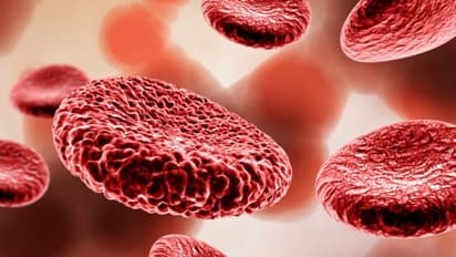 വിളര്‍ച്ചയെ തടയാന്‍ വീട്ടിലുള്ള ഈ ഭക്ഷണങ്ങള്‍ കഴിക്കാം...