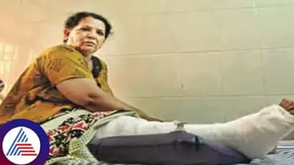 ಅಯ್ಯೋ ದೇವ್ರೇ..ಎಡಗಾಲಿನಲ್ಲಿ ನೋವಿದ್ದ ಮಹಿಳೆಯ ಬಲಗಾಲಿಗೆ ಶಸ್ತ್ರಚಿಕಿತ್ಸೆ ಮಾಡಿದ ಡಾಕ್ಟರ್ಸ್!