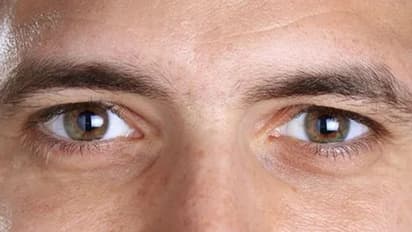 Eye Disease: கண் சார்ந்த நோய்களை குணப்படுத்த சூப்பரான 5 டிப்ஸ்!