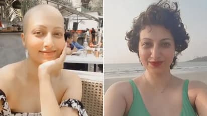 'അന്നും ഇന്നും'; ക്യാൻസര്‍ രോഗമുണ്ടാക്കിയ മാറ്റം കാണിക്കുന്ന വീഡിയോ പങ്കിട്ട് നടി...