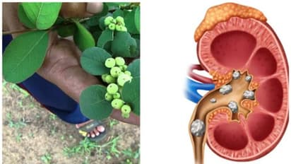 ఈ ఆకు రసంతో కిడ్నీలో రాళ్లు కరగడమే కాదు ఆ సమస్యలు కూడా దూరం?