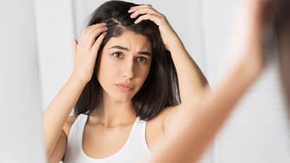 താരൻ അകറ്റാൻ ഇതാ നാല് കിടിലന് ഹെയര് മാസ്കുകള്...