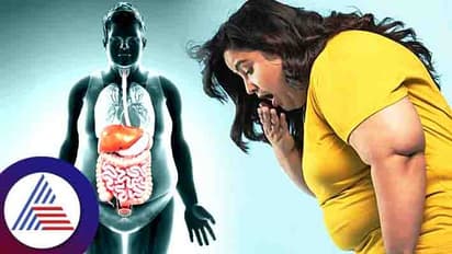 ಹೆಚ್ಚು ತಿನ್ನೋದ್ರಿಂದ ಬೊಜ್ಜು ಬರೋಲ್ಲ, ನೀವು ಮಾಡುವ ಈ ತಪ್ಪುಗಳೇ ಕಾರಣ!