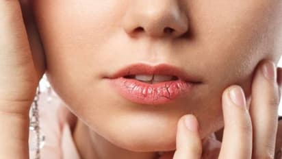 குளிர்கால வறட்சியால் உதடு வெடிப்பா? ஈஸியா சரி செய்ய டிப்ஸ்!