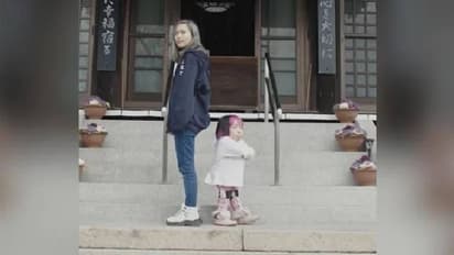 ഈ ഇരട്ട സഹോദരിമാർ തമ്മിലുള്ള ഉയരവ്യത്യാസം 75 സെൻറീമീറ്റർ