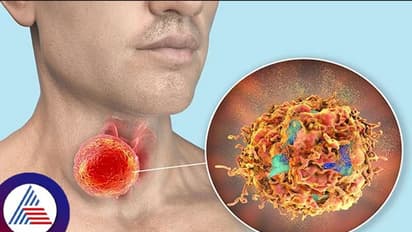 ವರ್ಕೌಟ್‌ ಬ್ರೇಕ್‌ನಲ್ಲಿ ರೋಟಿ ತಿಂದ ಬಾಡಿ ಬಿಲ್ಡರ್, ಗಂಟಲಲ್ಲಿ ಆಹಾರ ಸಿಲುಕಿ ಸಾವು