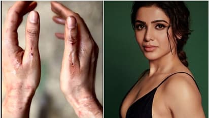 ಅಯ್ಯೋ..! ಮತ್ತೇ ಏನಾಯ್ತು; ರಕ್ತ ಸೋರುತ್ತಿರುವ ಸಮಂತಾ ಕೈ ನೋಡಿ ಫ್ಯಾನ್ಸ್ ಶಾಕ್