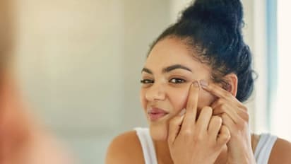 മുഖത്തെ കറുത്ത പാടുകളെ എളുപ്പം അകറ്റാം; വീട്ടില്‍ പരീക്ഷിക്കാം ഈ ഫേസ് പാക്കുകള്‍...
