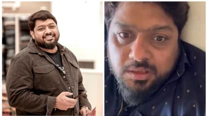 Bell's Palsy : നടന് മിഥുന് രമേശിനെ ബാധിച്ച ബെല്സ് പാള്സി : പ്രധാനപ്പെട്ട ലക്ഷണങ്ങൾ