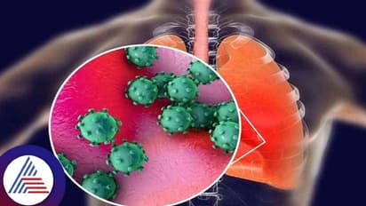 ದೇಶಾದ್ಯಂತ ವ್ಯಾಪಕ ಜ್ವರ, ಕೆಮ್ಮಿನ ಹಾವಳಿ, H3N2 ವೈರಸ್ ಕಾರಣ ಎಂದ ತಜ್ಞರು