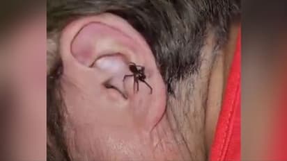 ചെവിയില് നിന്ന് എട്ടുകാലി ഇഴഞ്ഞ് പുറത്തേക്ക് വരുന്നു; വീഡിയോ വൈറലാകുന്നു...